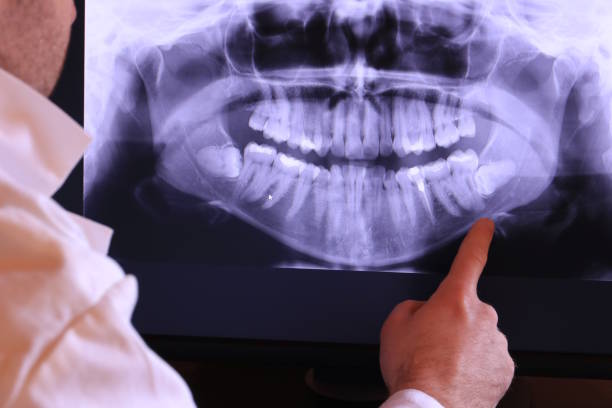 Best Urgent Care for Lost Fillings or Crowns in Apple Valley, MN